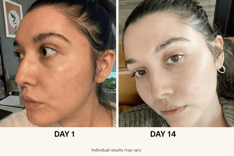 5 Set Anua Skincare Bundle