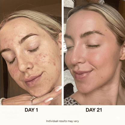 5 Set Anua Skincare Bundle