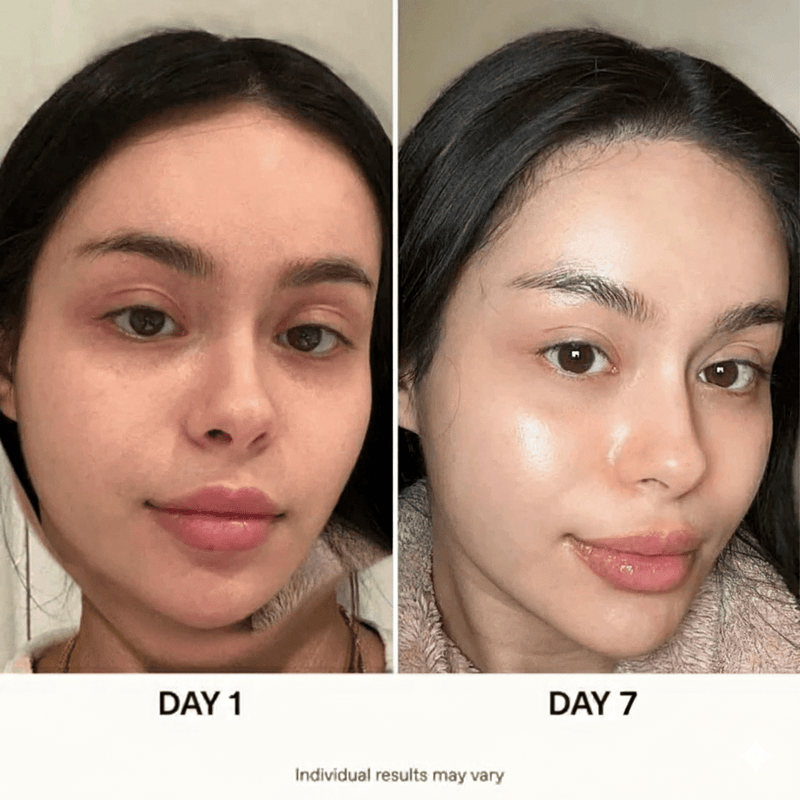 5 Set Anua Skincare Bundle